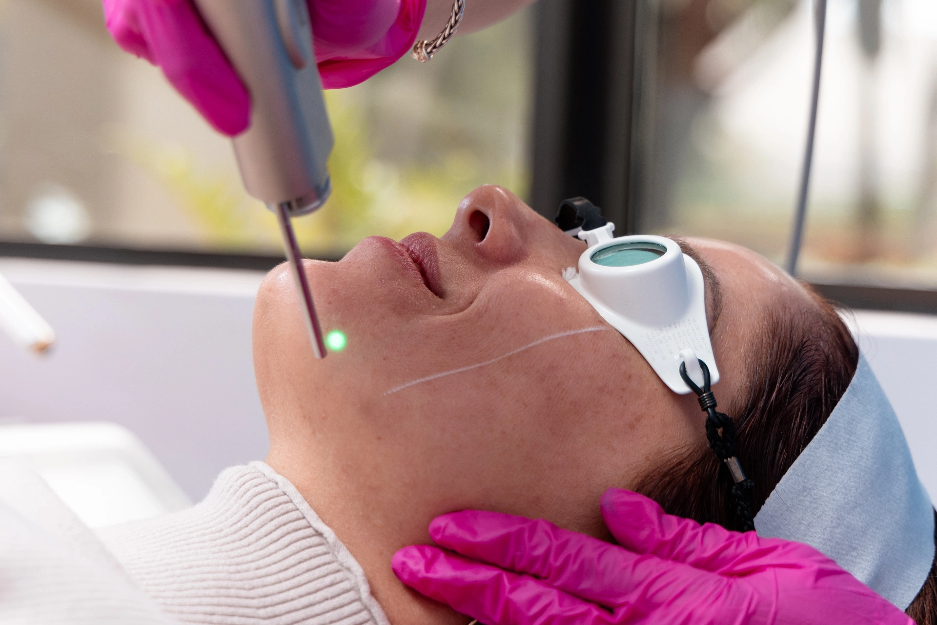 Fotona facial laser treatment at Ageless Perfection Miami