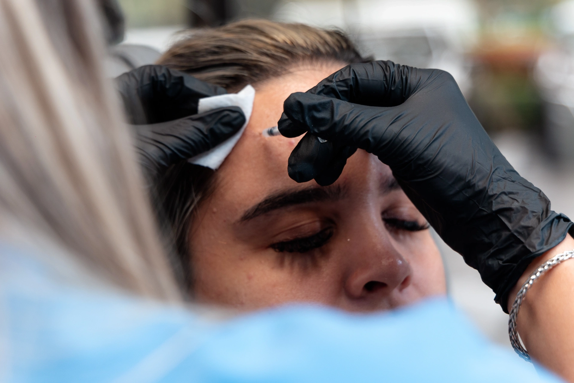 Botox being applied to the forehead at Ageless Perfection Miami